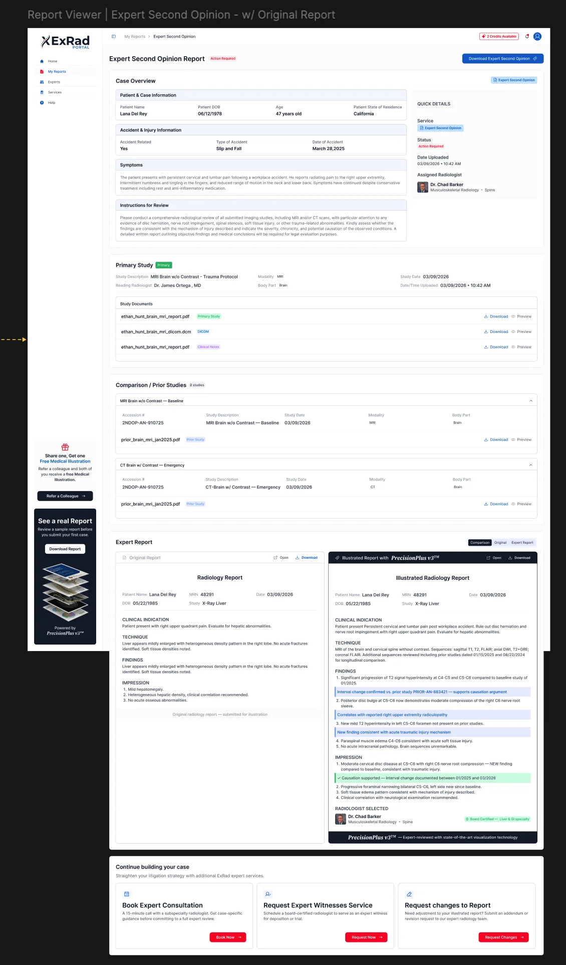ExRad Portal Report Viewer Expert Second Opinion